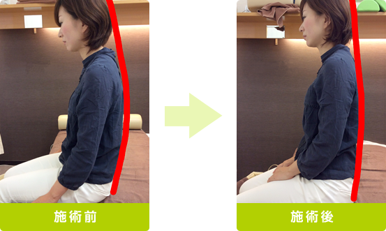 姿勢改善プログラム